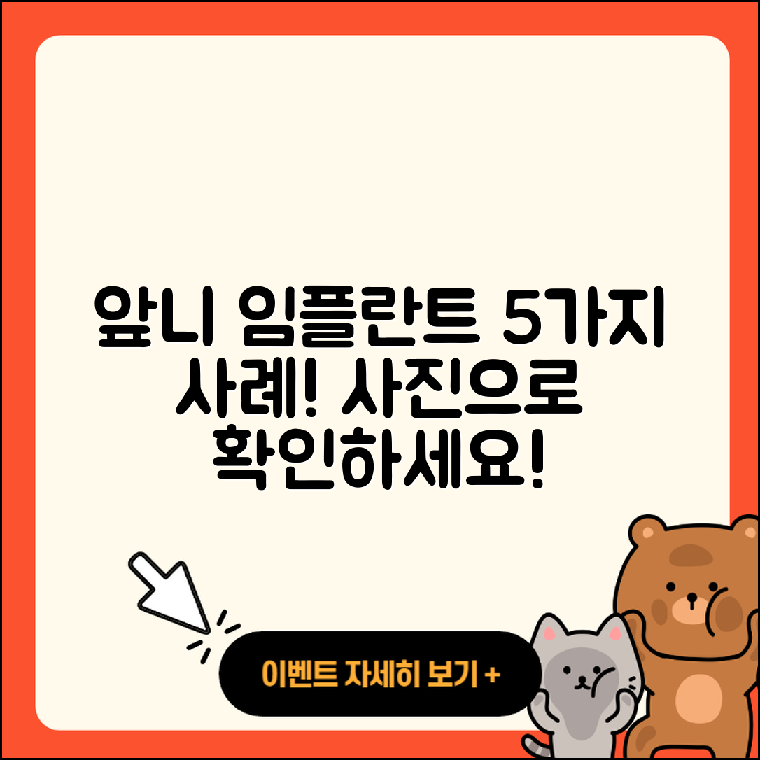 앞니 임플란트 사진으로 보는 5가지 사례